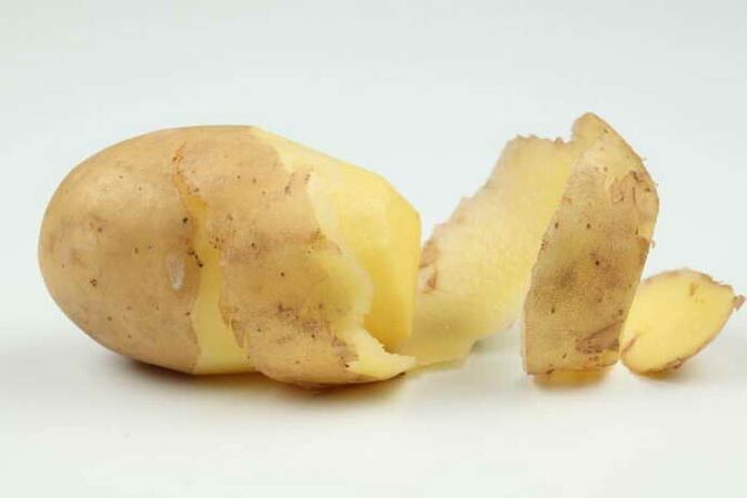 servikal osteokondroz tedavisi için patates