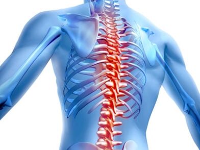 osteokondrozlu spinal lezyon
