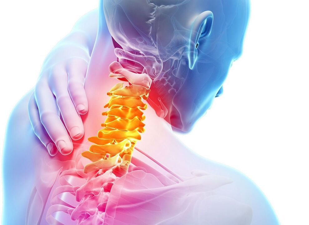 Spinal osteokondroz belirtileri