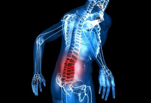 Osteokondroz semptomları