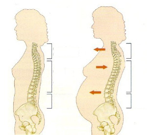 hamilelik sırasında osteokondroz